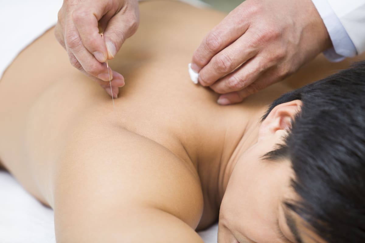 acupuncture et sommeil
